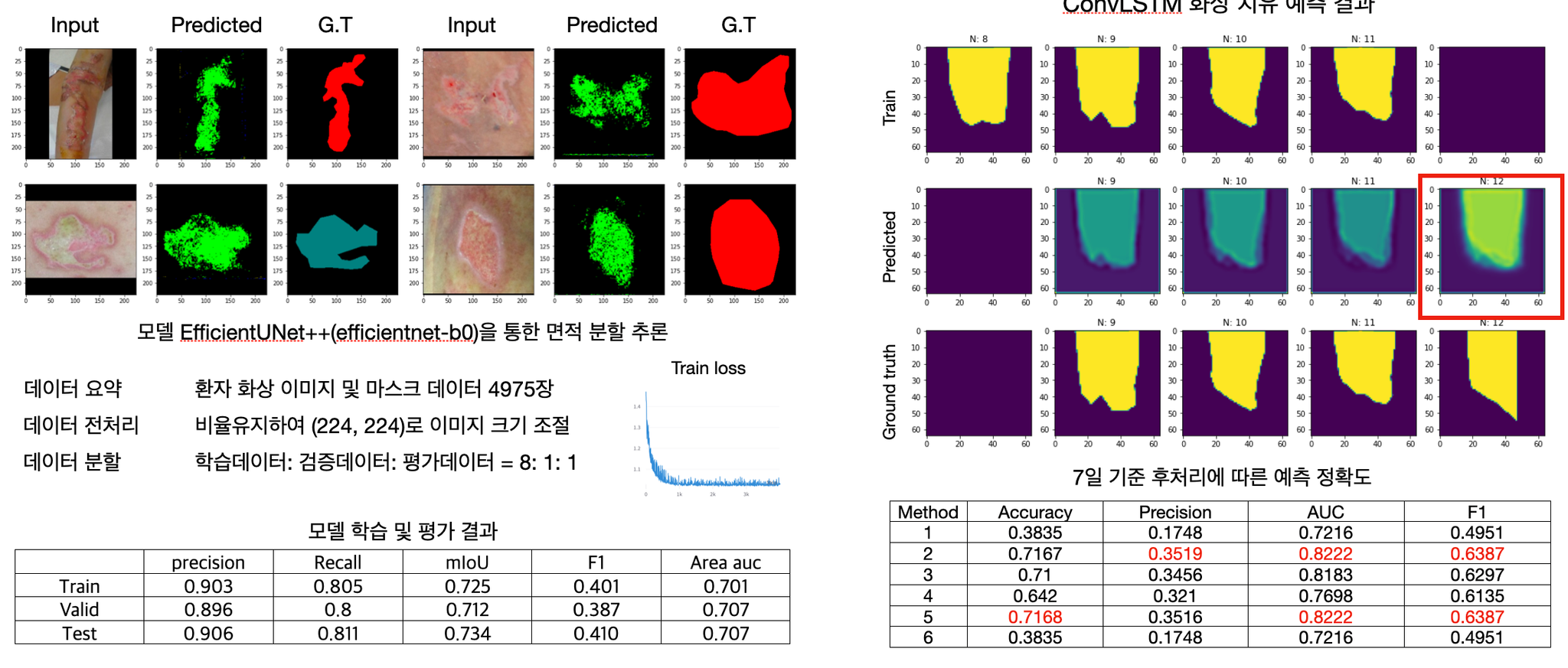 Burn detection inference and segmentation result visual